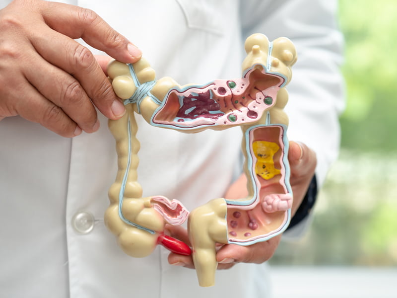 Gastric-Oncology-Dr.-Azriel-Hirschfeld Gastric-Oncology-Dr.-Azriel-Hirschfeld