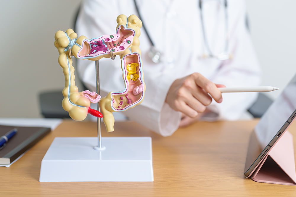 STAGE-4-BILE-DUCT-CANCER STAGE-4-BILE-DUCT-CANCER