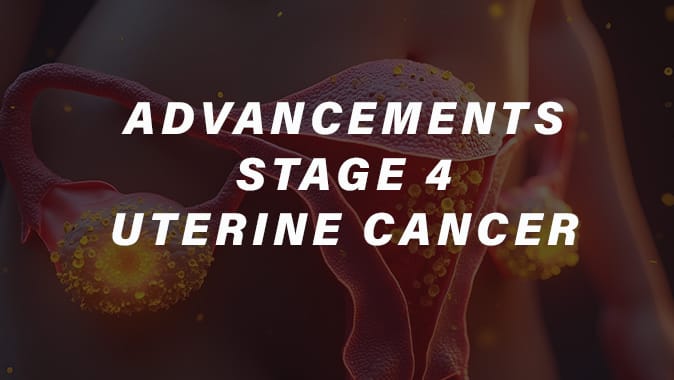 UTERINE-CANCER-STAGE-4jpg UTERINE-CANCER-STAGE-4jpg